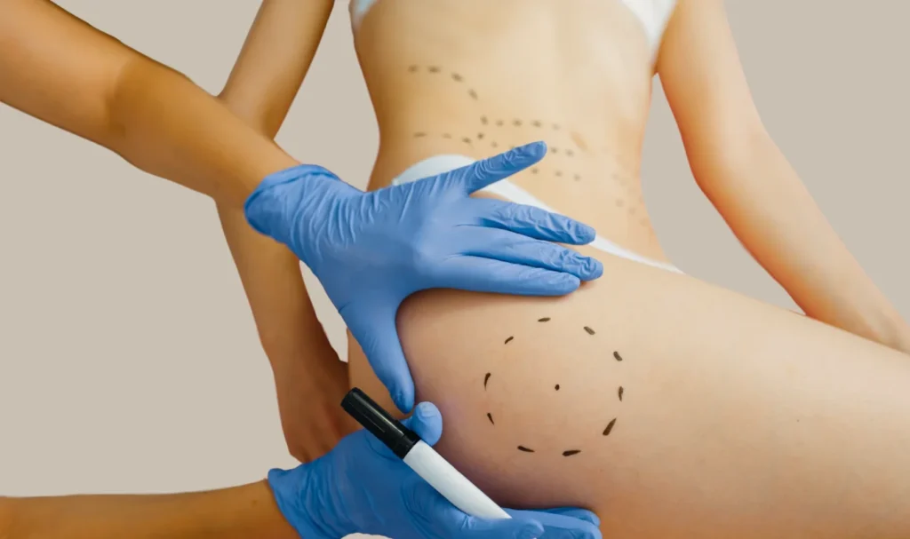 11 2 Dr. Carlos Cala