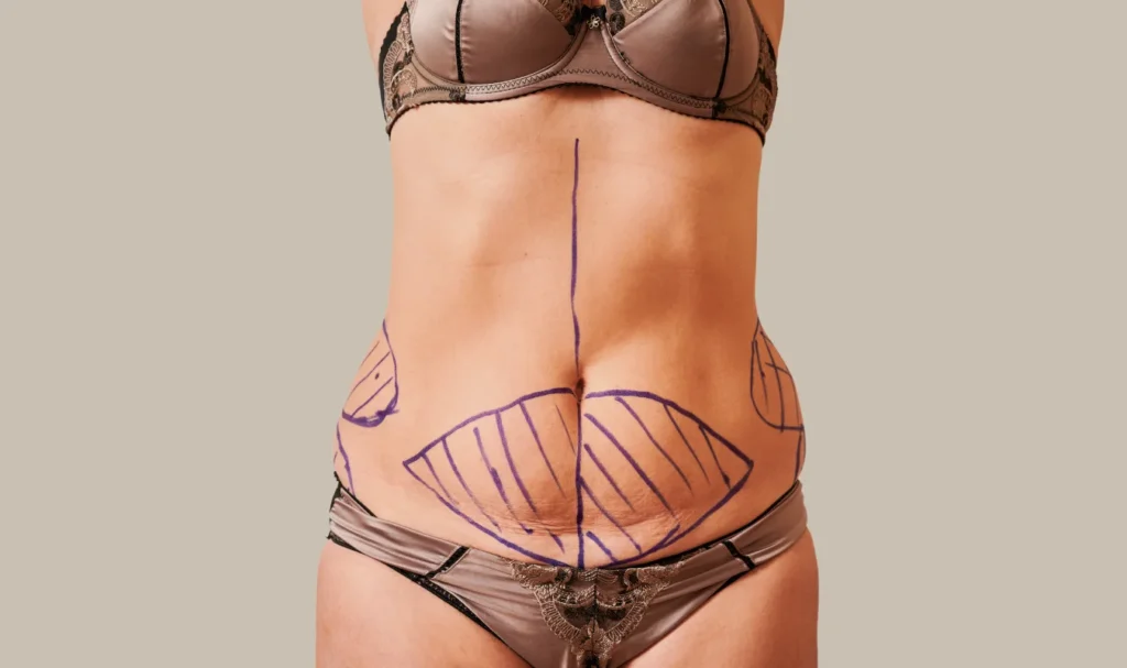 16 1 Dr. Carlos Cala