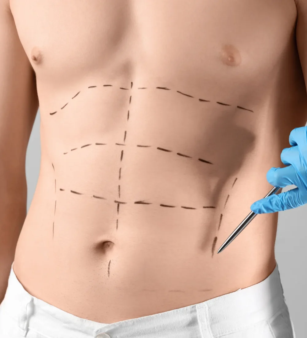 Cirugia plastica para hombres imagen